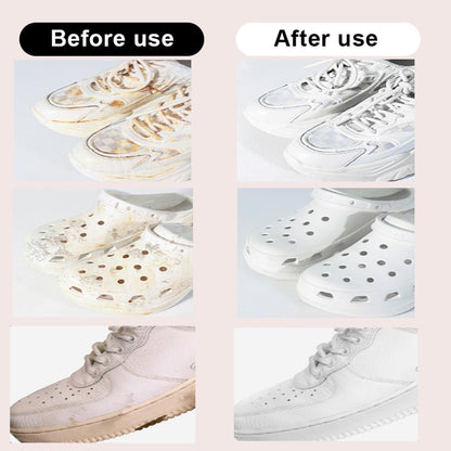 Stain Removal Wet Wipes – Multi-Functional Cleaner for Cotton, Leather & Down Jackets